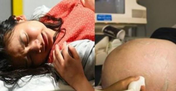 媳婦懷上10斤巨嬰，婆婆卻要求順產，寶寶出生後全家人後悔不已